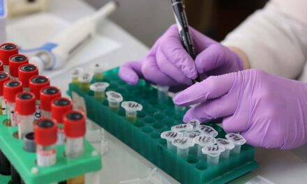 Registros de contagios elevados en la Región