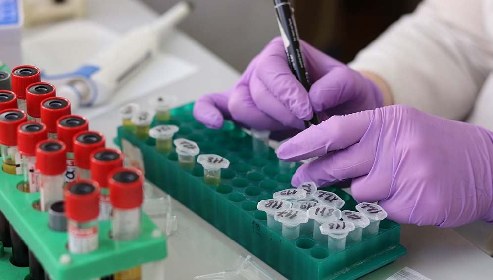 Miércoles y los contagios reportados desde Santa Fe